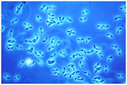Toxoplasma gondii parasitter (tachyzoitter)