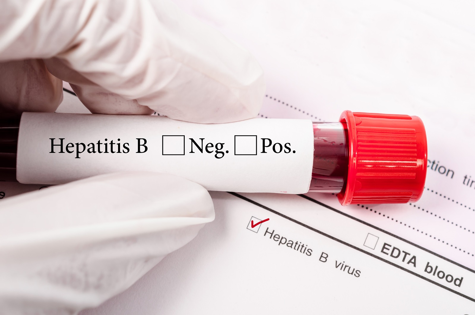 Billede af hepatitis B prøve