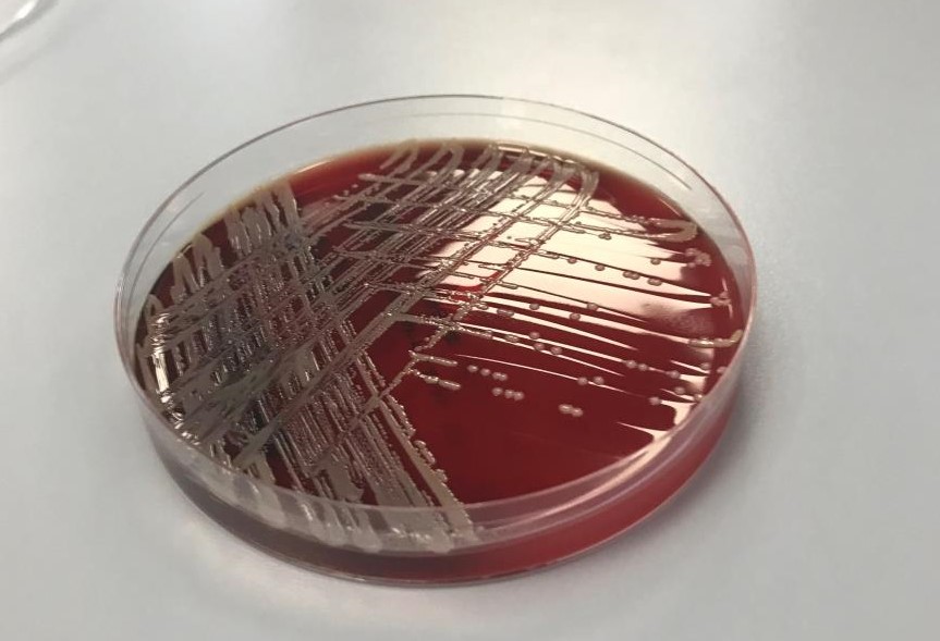 MRSA