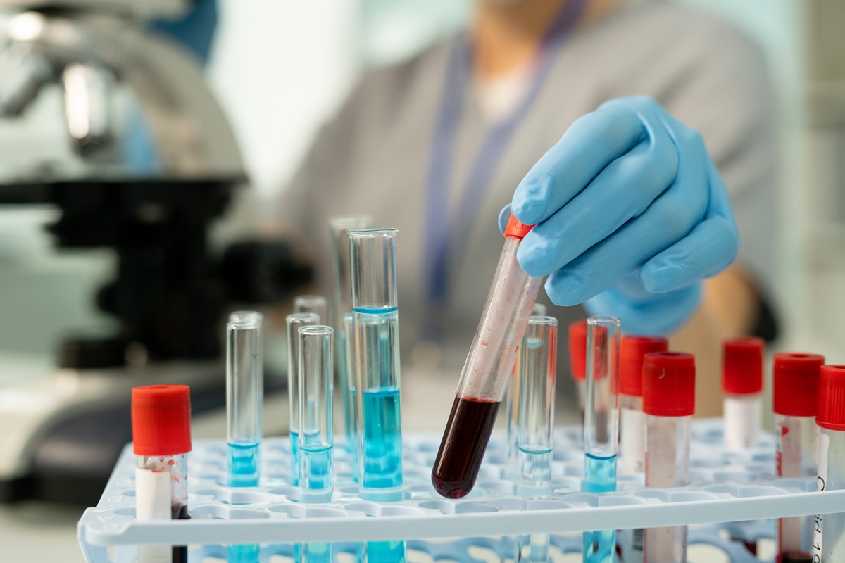 Hånd med blå handske holder reagensglas