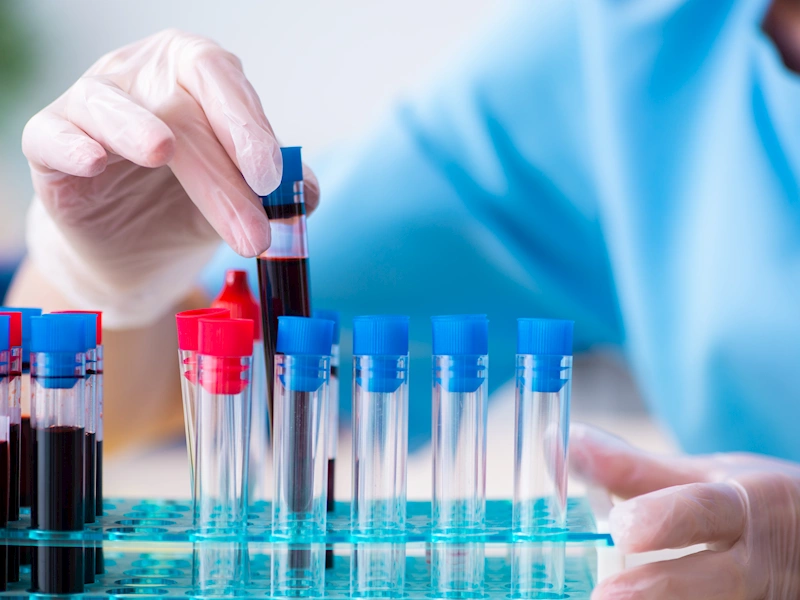 Antallet af nye hiv-diagnoser fortsætter med at falde