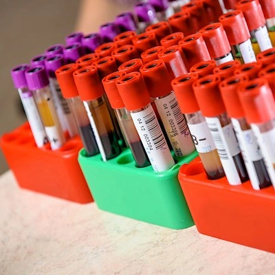 SSI tilbyder ca. 330 diagnostiske analyser - du kan finde dem i Diagnostisk Håndbog