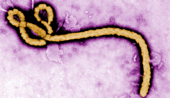 Ebola virus i elektronmikroskop