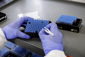 PCR-analyse