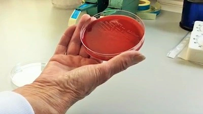 Forskningsnyhed Listeria 01